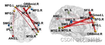 FNIRS功能近红外数据处理服务
